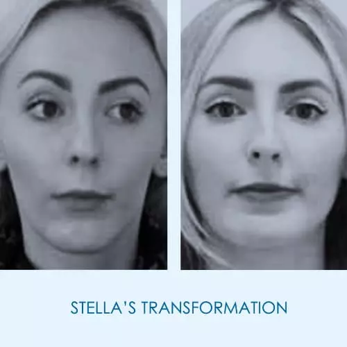 Stella's Testimonial image