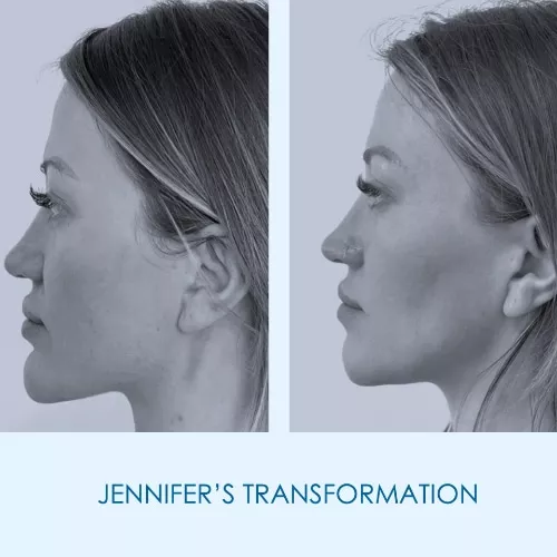 Jennifer's Testimonial image