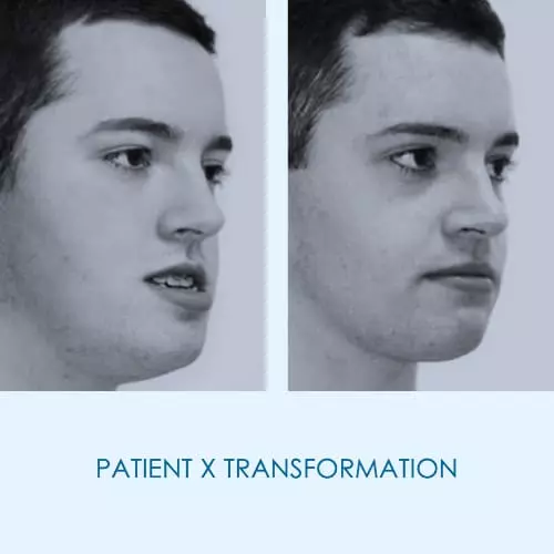 Patient X's Testimonial image